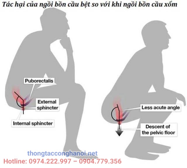 bồn cầu nào tốt cho sức khỏe